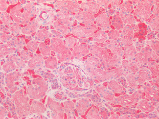 SOD2 (MnSOD) Antibody in Immunohistochemistry (Paraffin) (IHC (P))