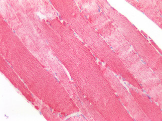 SOD2 (MnSOD) Antibody in Immunohistochemistry (Paraffin) (IHC (P))