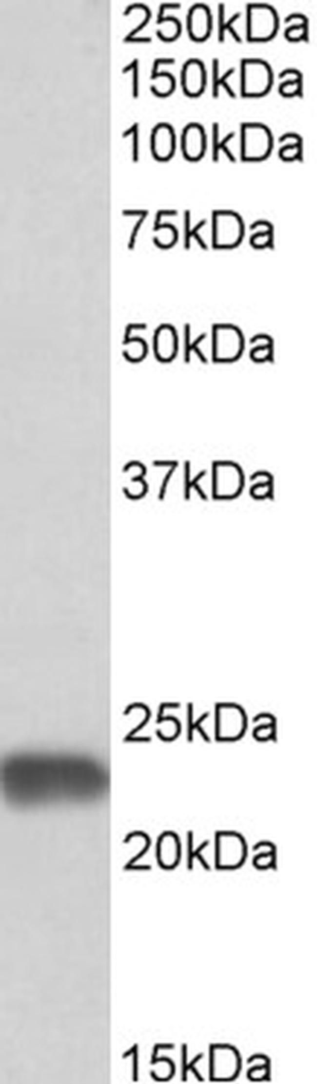 SOD2 (MnSOD) Antibody in Western Blot (WB)