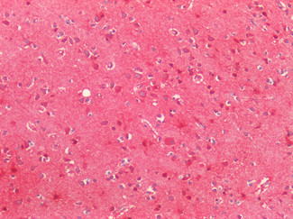 SOD2 (MnSOD) Antibody in Immunohistochemistry (Paraffin) (IHC (P))