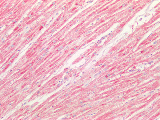 SOD2 (MnSOD) Antibody in Immunohistochemistry (Paraffin) (IHC (P))