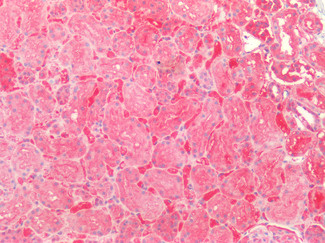 SOD2 (MnSOD) Antibody in Immunohistochemistry (Paraffin) (IHC (P))