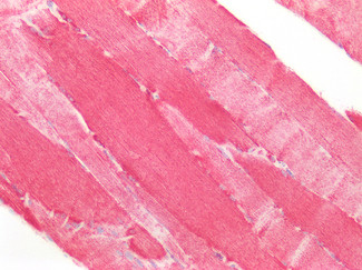 SOD2 (MnSOD) Antibody in Immunohistochemistry (Paraffin) (IHC (P))