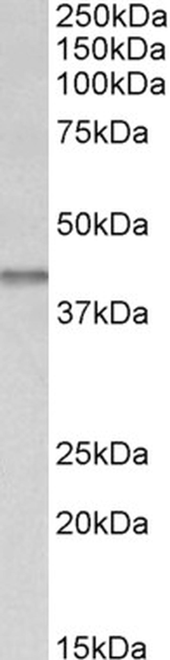 IDH3B Antibody in Western Blot (WB)