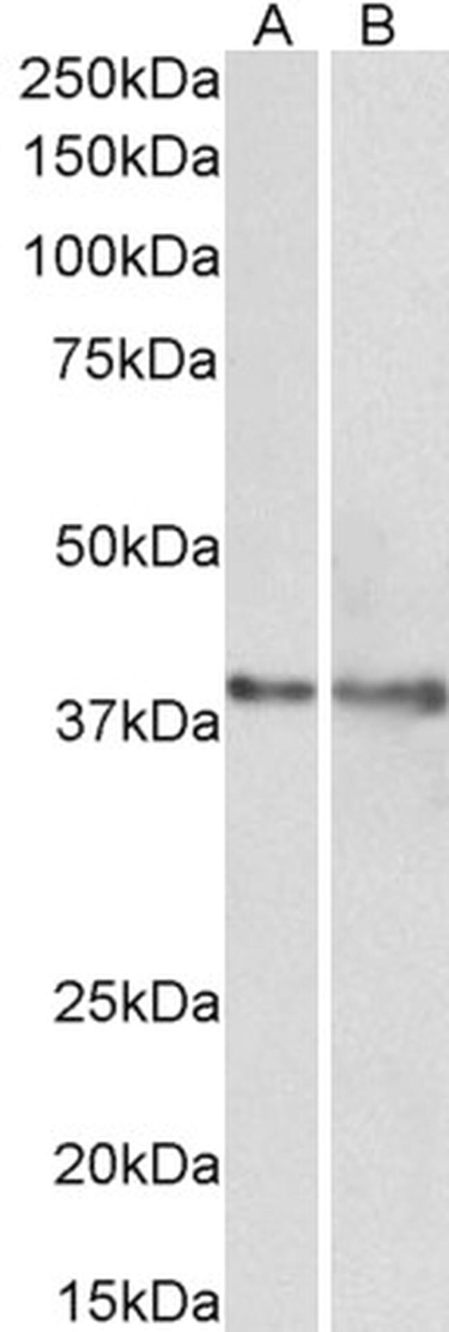 IDH3G Antibody in Western Blot (WB)