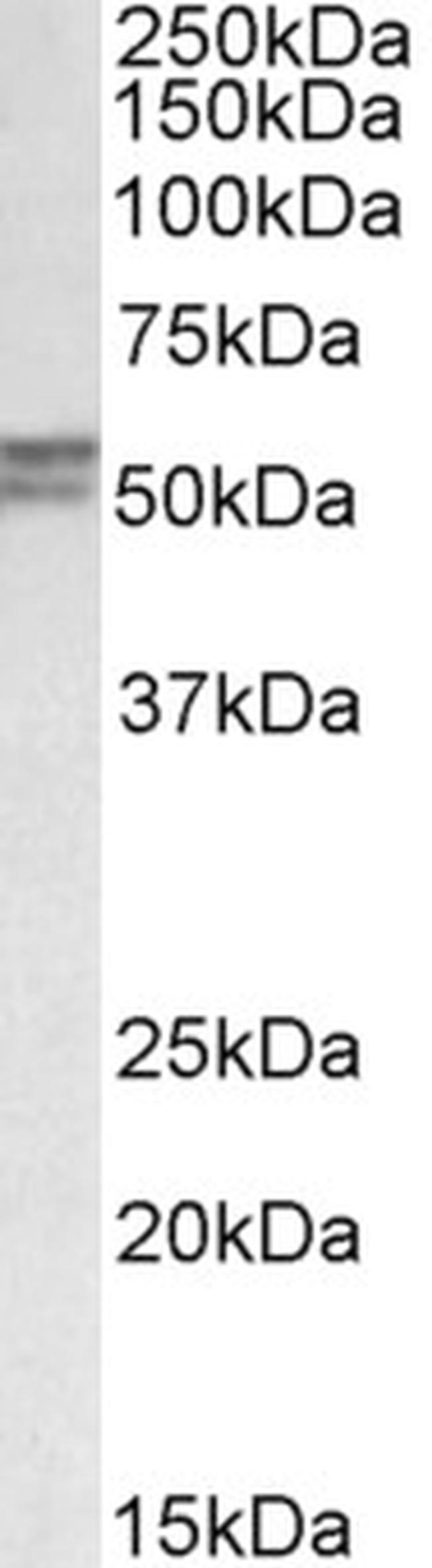 DGAT1 Antibody in Western Blot (WB)