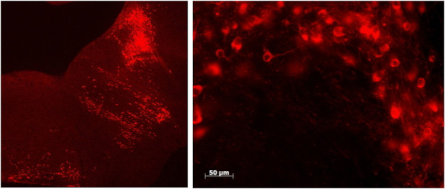 TPH2 Antibody in Immunohistochemistry (IHC)