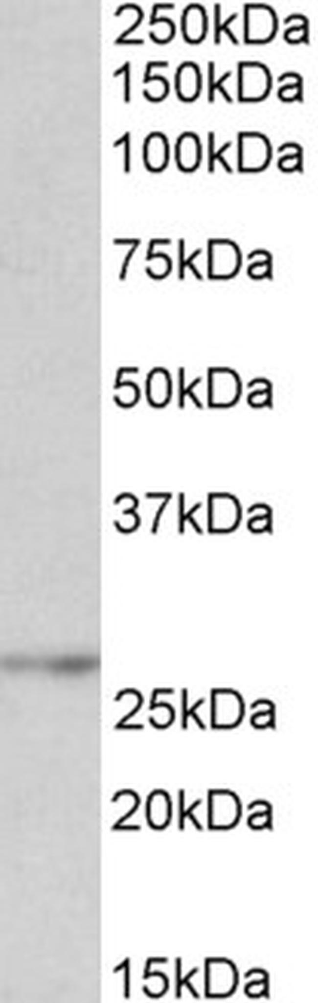 NMNAT3 Antibody in Western Blot (WB)