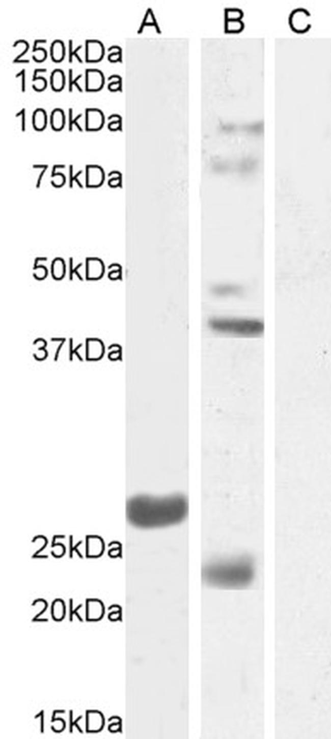 FGF23 Antibody in Western Blot (WB)