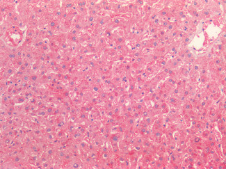 TNFR2 Antibody in Immunohistochemistry (Paraffin) (IHC (P))