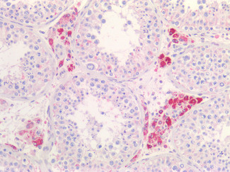 TNFR2 Antibody in Immunohistochemistry (Paraffin) (IHC (P))