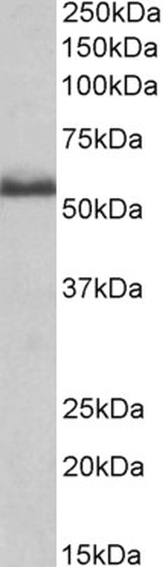 TNFR2 Antibody in Western Blot (WB)