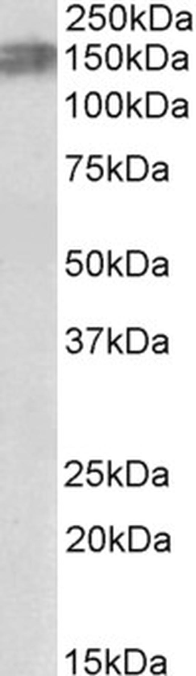 ALK Antibody in Western Blot (WB)