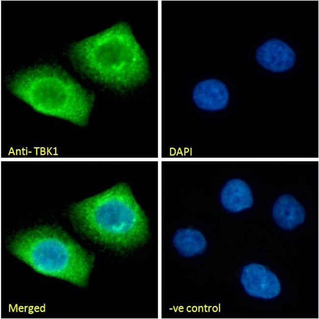 TBK1 Antibody in Immunocytochemistry (ICC/IF)