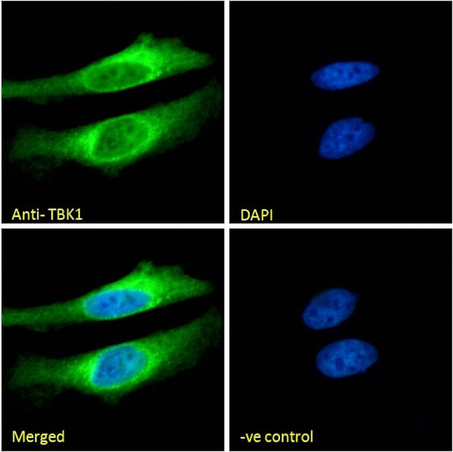 TBK1 Antibody in Immunocytochemistry (ICC/IF)