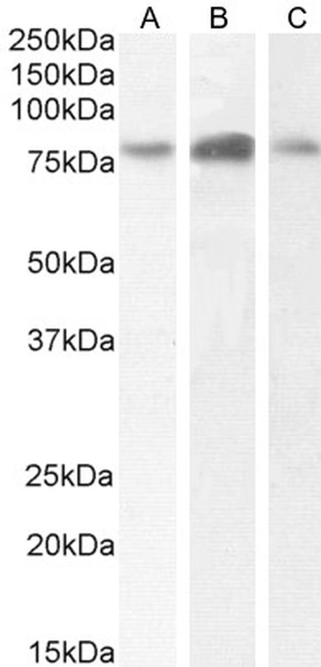 TBK1 Antibody in Western Blot (WB)