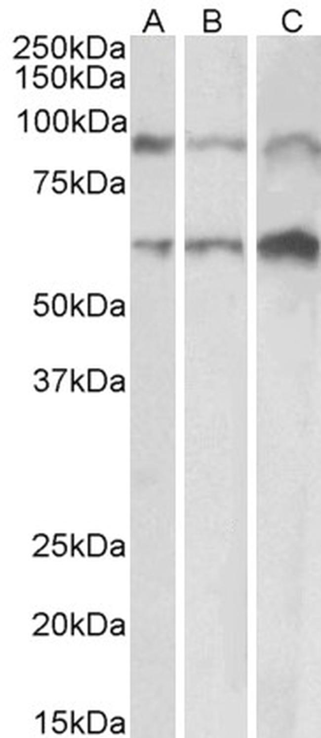 ADAM12 Antibody in Western Blot (WB)