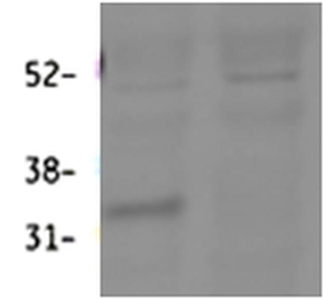 HSD11B1 Antibody in Western Blot (WB)