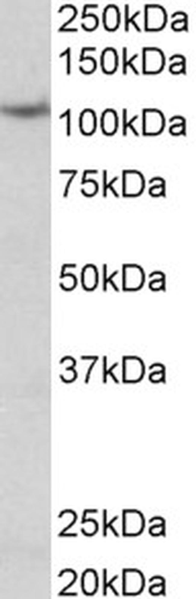 Thyroid Peroxidase Antibody in Western Blot (WB)