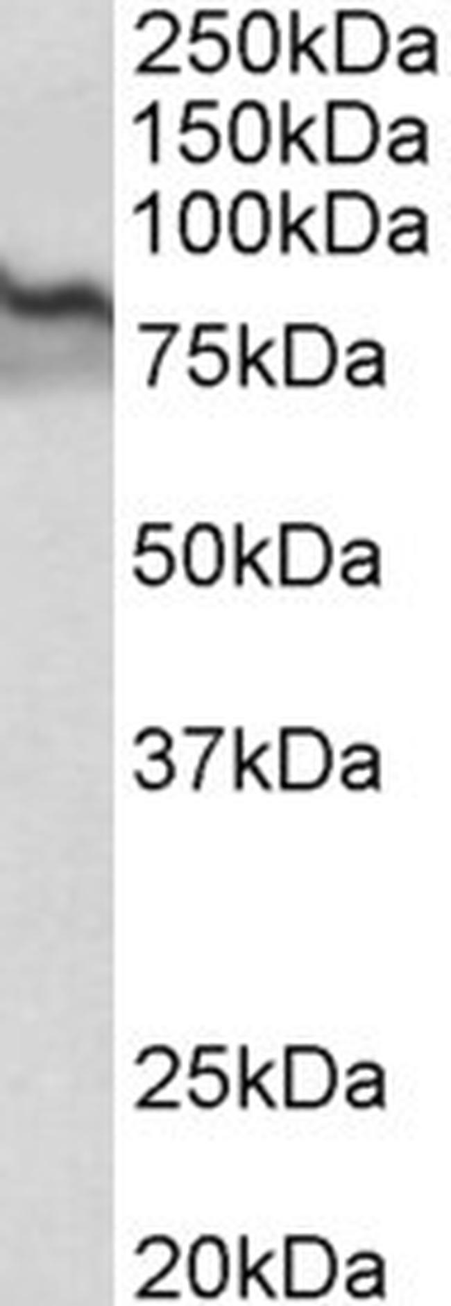 TGM2 Antibody in Western Blot (WB)