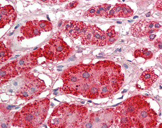 ACACB Antibody in Immunohistochemistry (Paraffin) (IHC (P))