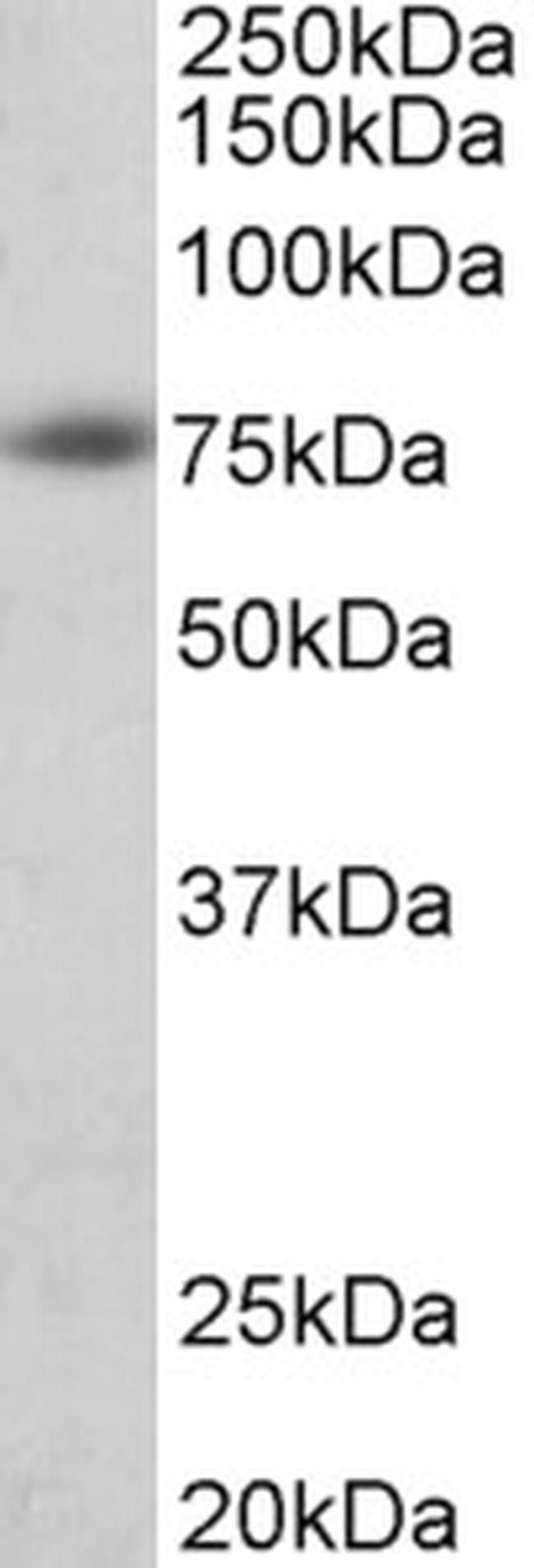 beta Amyloid Antibody in Western Blot (WB)