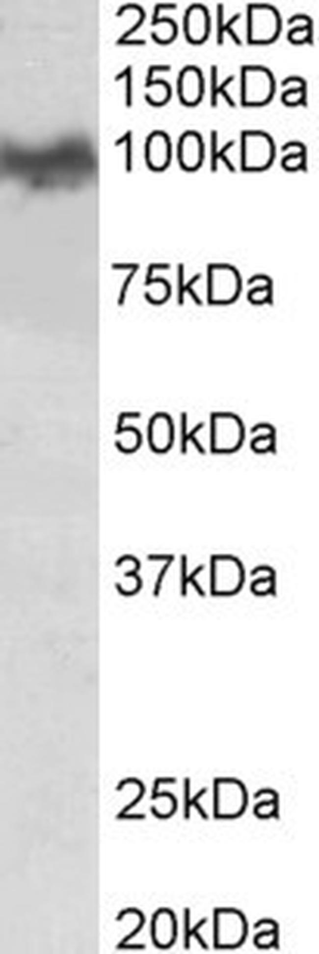 beta Amyloid Antibody in Western Blot (WB)