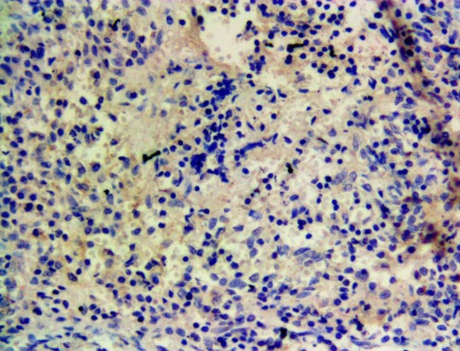 CYP1A1 Antibody in Immunohistochemistry (Paraffin) (IHC (P))