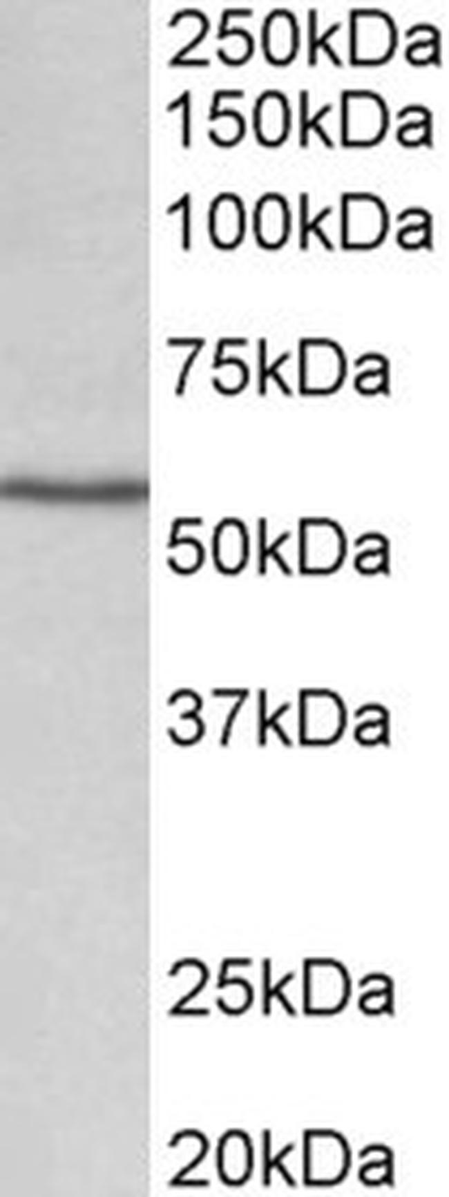 CYP1A1 Antibody in Western Blot (WB)