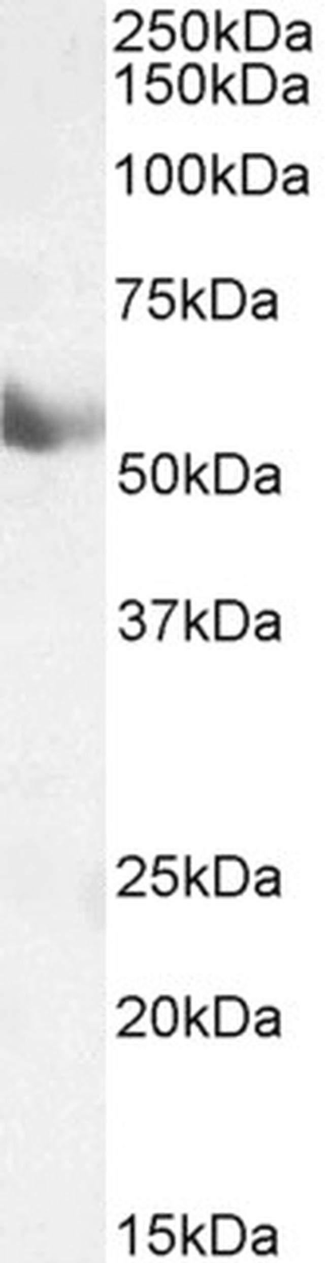 CYP1A1 Antibody in Western Blot (WB)