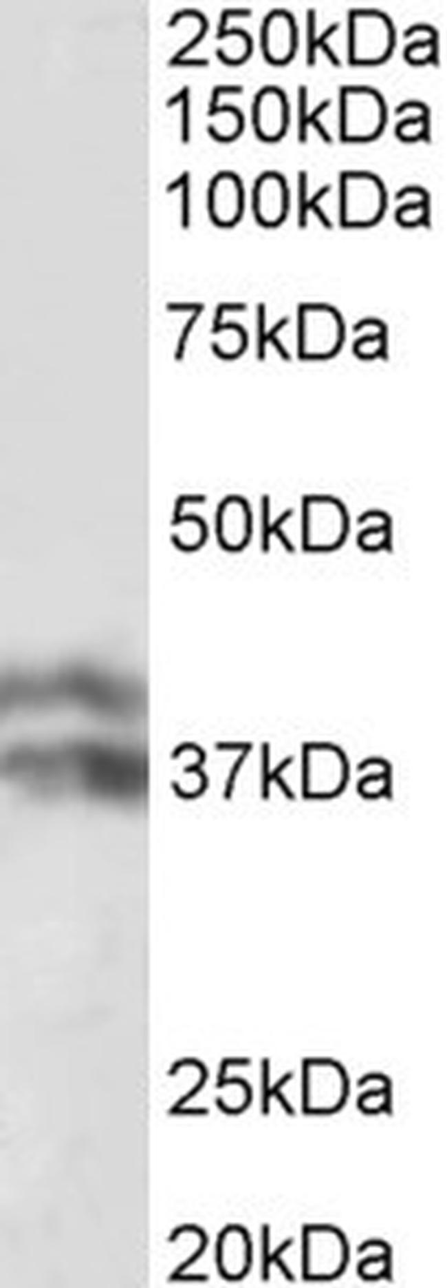 Haptoglobin beta Antibody in Western Blot (WB)