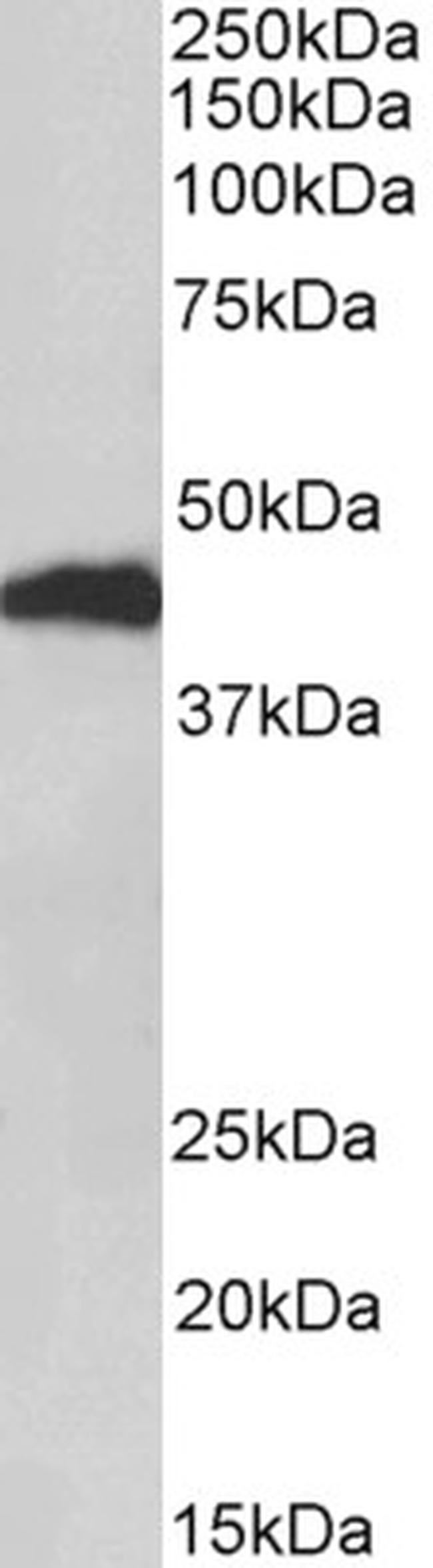 Haptoglobin beta Antibody in Western Blot (WB)