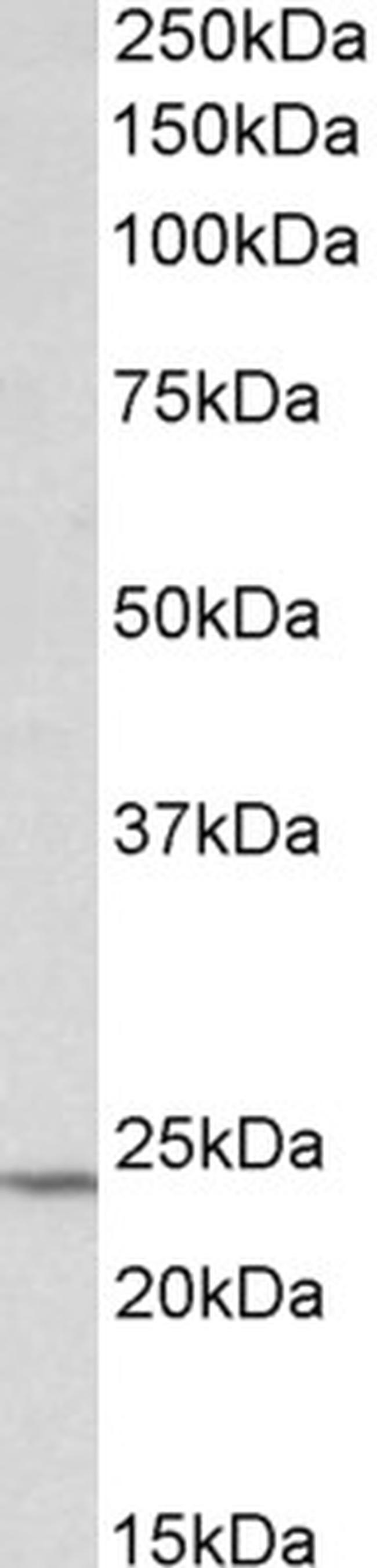 TIMP1 Antibody in Western Blot (WB)