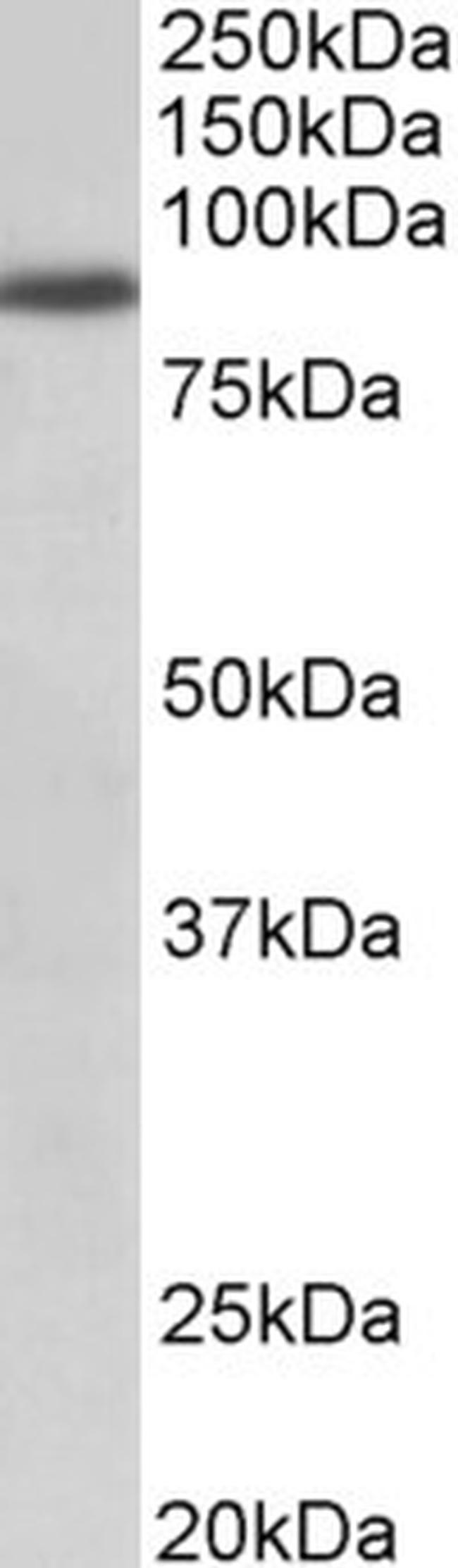 FGFR1 Antibody in Western Blot (WB)