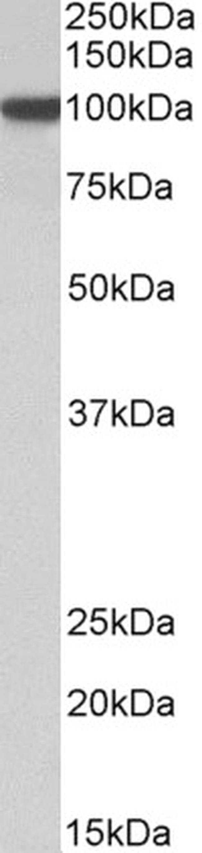 HIF-1 beta Antibody in Western Blot (WB)