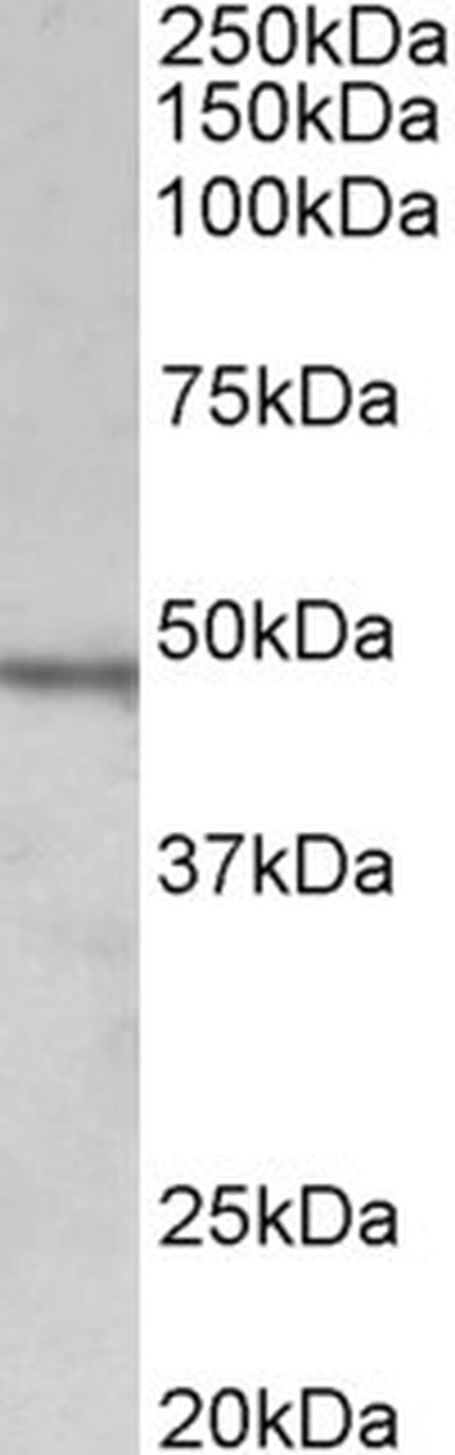 Chitotriosidase Antibody in Western Blot (WB)