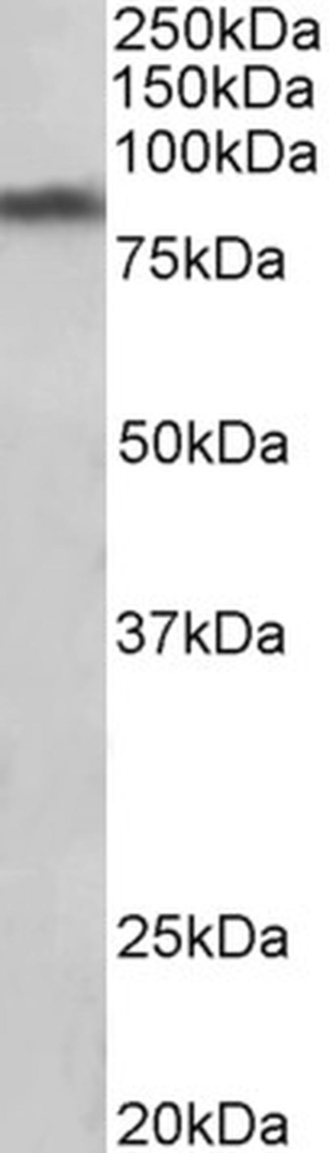 Dopamine Transporter Antibody in Western Blot (WB)