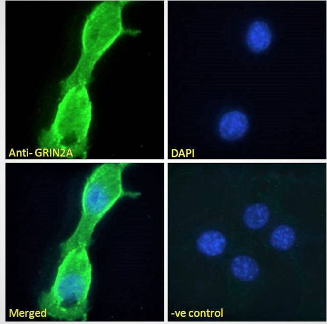 NMDAR2A Antibody in Immunocytochemistry (ICC/IF)