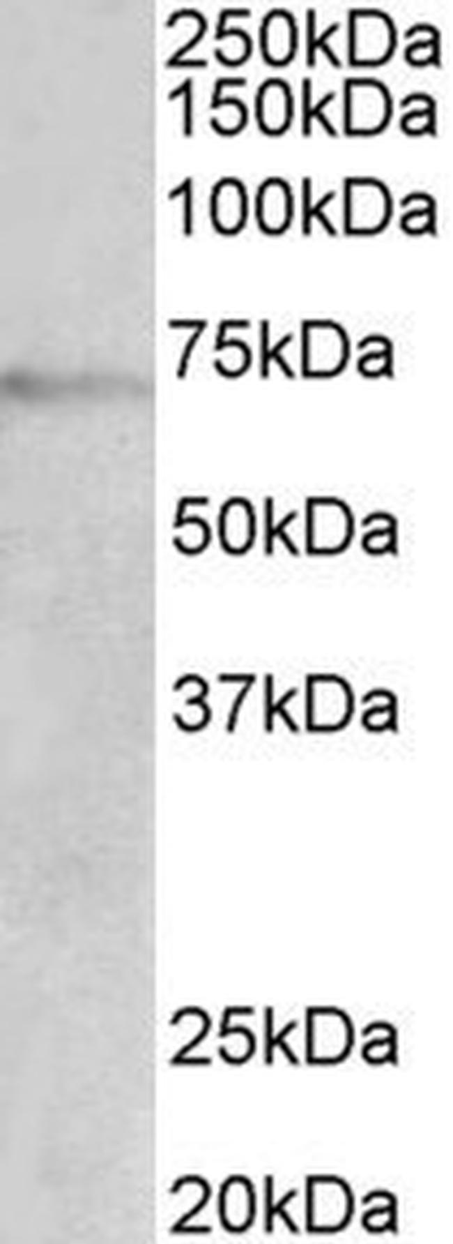 Dopamine beta Hydroxylase Antibody in Western Blot (WB)