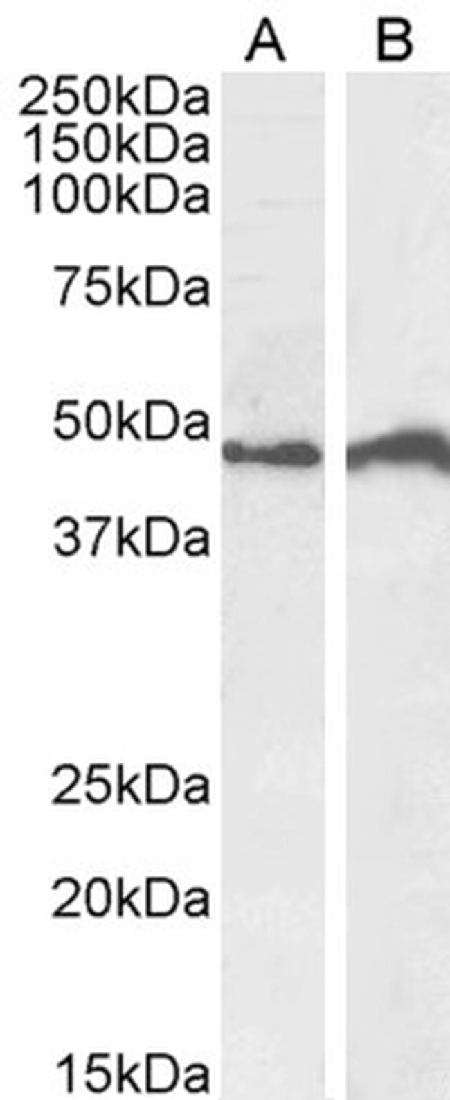 IRF4 Antibody in Western Blot (WB)