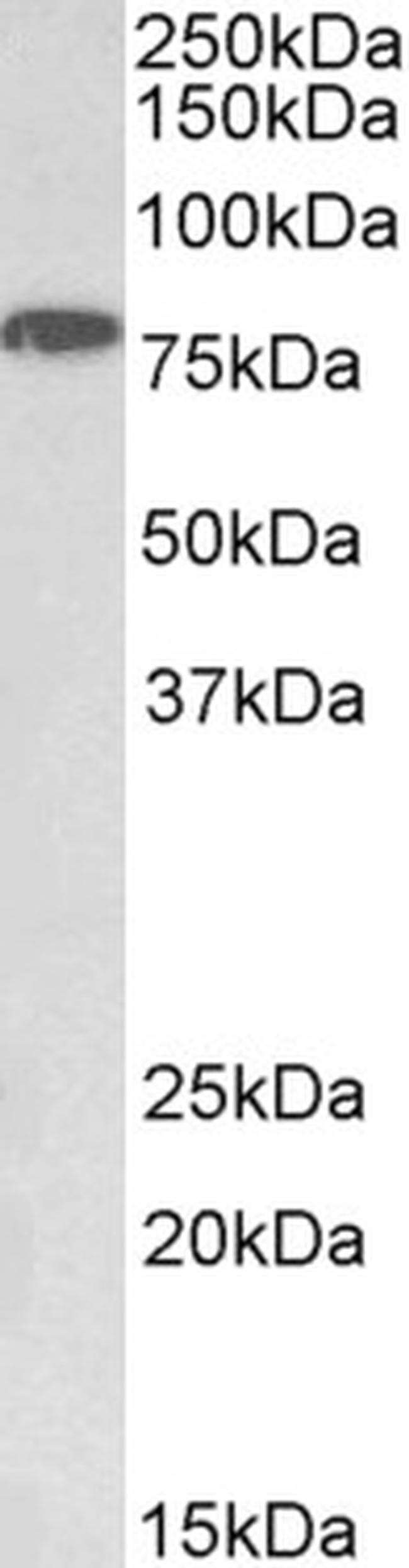 IKK alpha Antibody in Western Blot (WB)