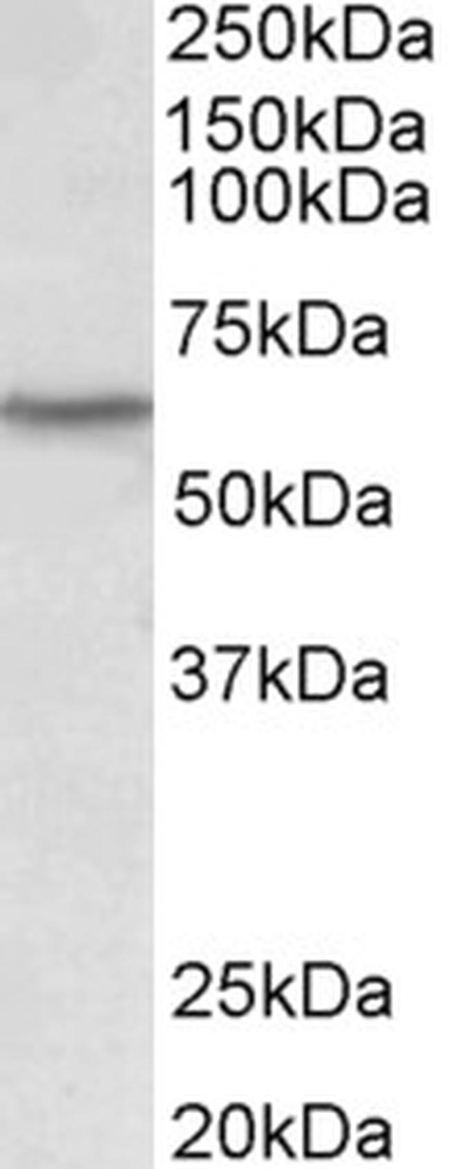 LCK Antibody in Western Blot (WB)