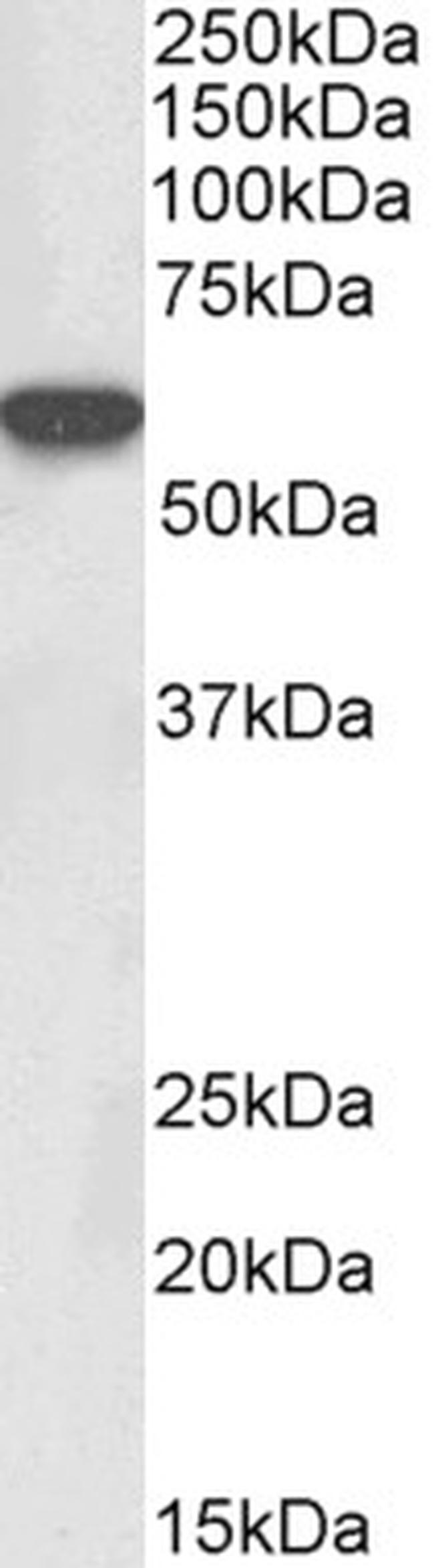 LCK Antibody in Western Blot (WB)