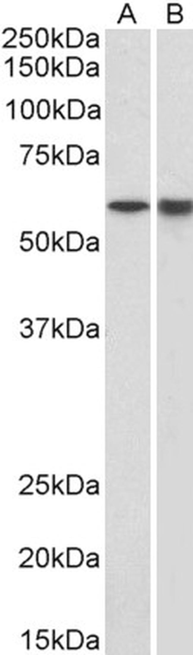 LCK Antibody in Western Blot (WB)