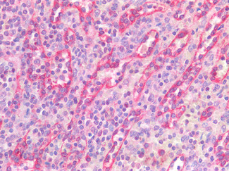 STAT5 alpha Antibody in Immunohistochemistry (Paraffin) (IHC (P))