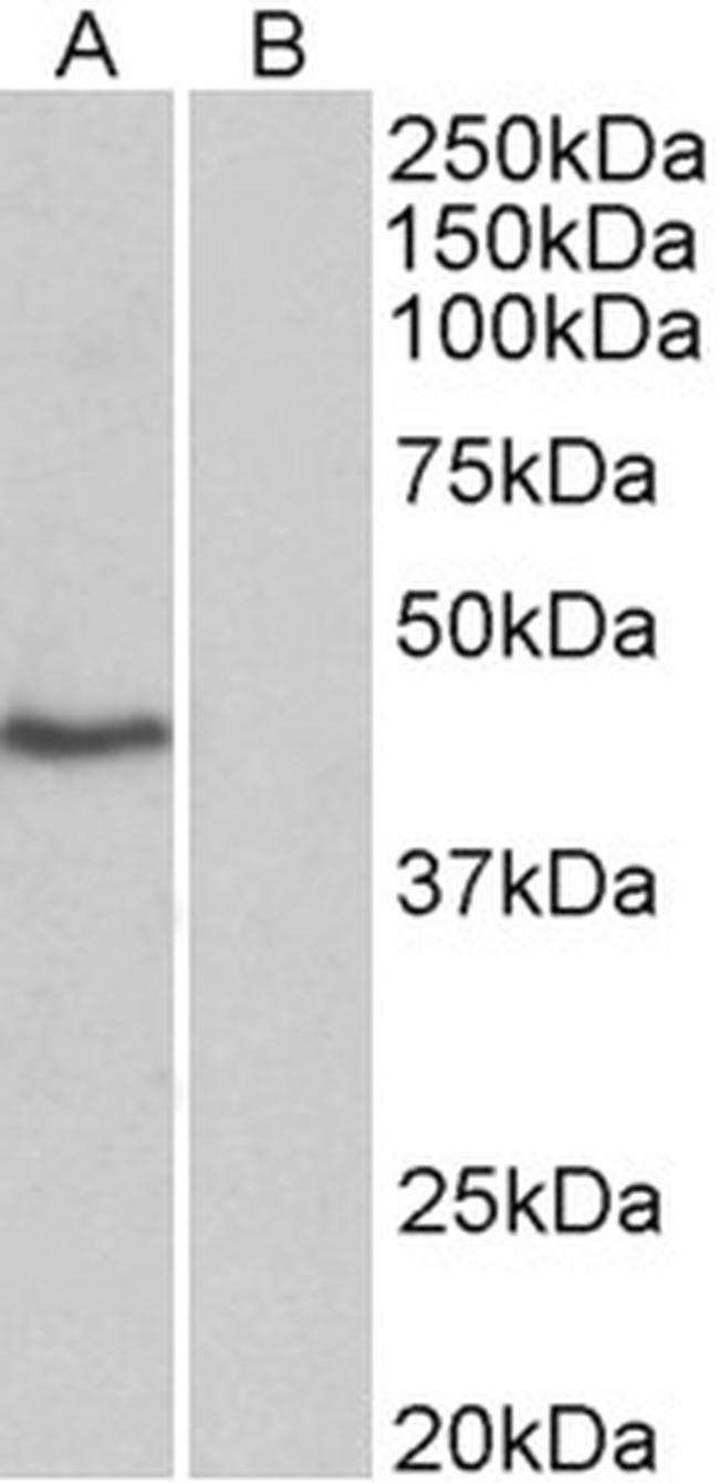 TBP Antibody in Western Blot (WB)