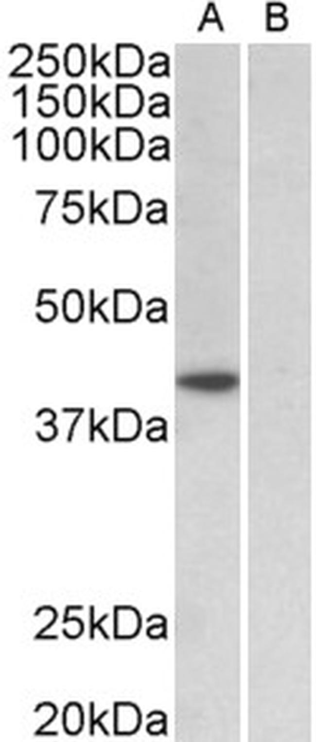 TBP Antibody in Western Blot (WB)