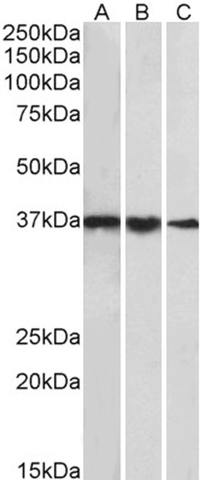 TBP Antibody in Western Blot (WB)