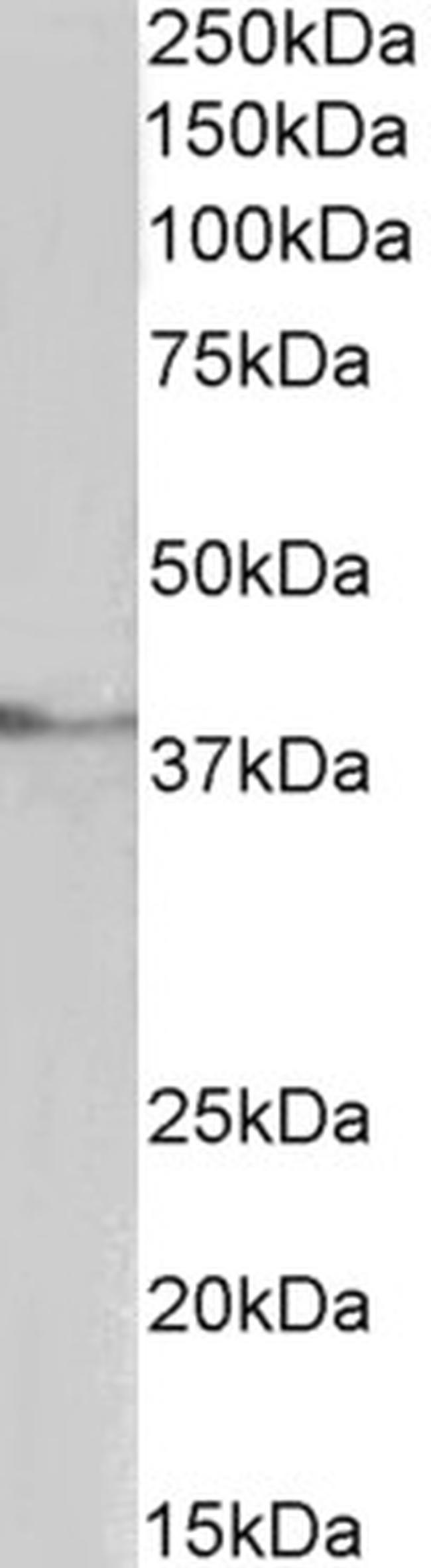 TBP Antibody in Western Blot (WB)