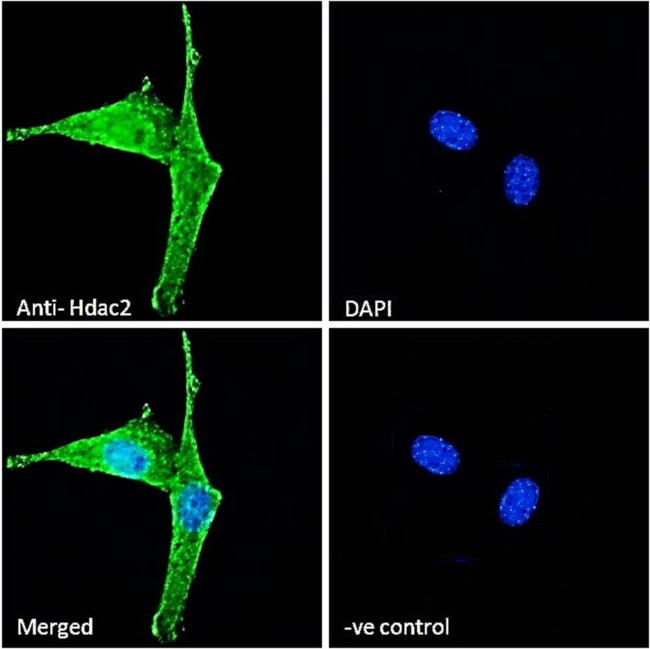 HDAC2 Antibody in Immunocytochemistry (ICC/IF)